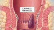 aimoroidopatheia