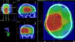 olokroniaki_aktinotherapeia