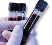 test_aima_syndr_down