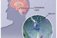 parkinson_new_therapy