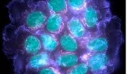 mielogenis_lefxaimia