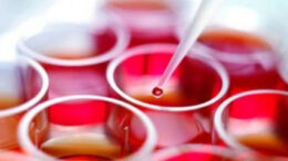 aima_emvriaka_kittara