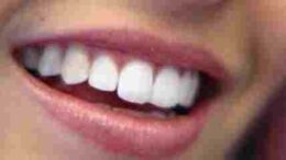 kaki_stomatiki_ygeiini