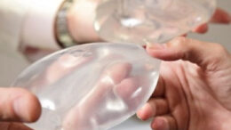 ypopta_emfit_stithous_GB