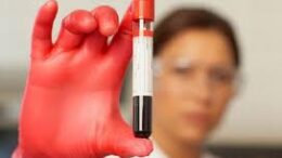 test_aimatos_emfragma