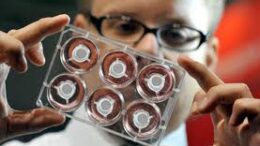 mikites_diatrofiki_alisida