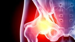 arthroplastiki_isxiou