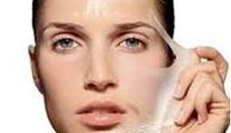 chemical_peeling