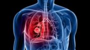 pagk_hmera_asthma