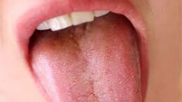 test_anapnohs_karkinos