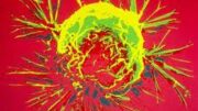chimiotherapeia
