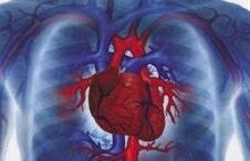 21_gonidia_xolisterini