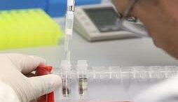 dimiourgia_nefrwn_sto_ergastirio