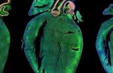 anagenissi_kardias_se_pontikia