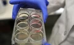 erithropiitini_swzei_zwes