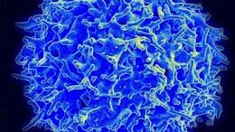 therapia_ths_lefxaimias