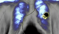 viologikos_vimatodotis