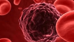 fysikos_diakoptis_ths_metastasis