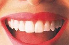 trofes_pou_lefkainoun_ta_dontia