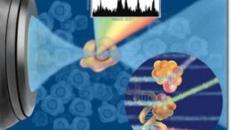 Laser-diagnosi-breast-cancer