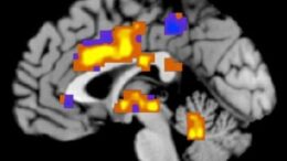 magnitikes_tomografies_metroun_ton_pono