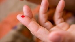 test_aimatos_mikites