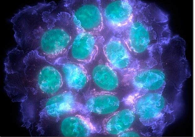 karkinika_kitara_katasteloun_ton_karkino