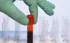 eksetasi_aimatos_HPV