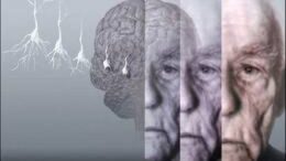 kardiakes_arithmies_anoia