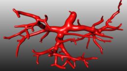 metamosxefsi_aimoforou_aggeiou