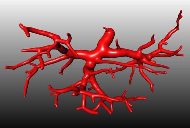 metamosxefsi_aimoforou_aggeiou