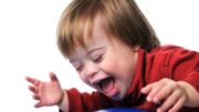 down_syndrome