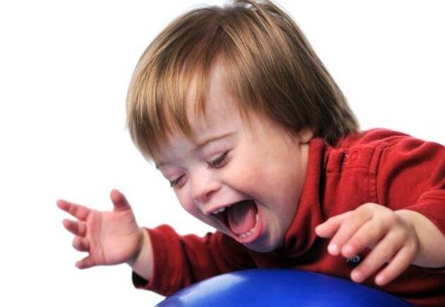 down_syndrome
