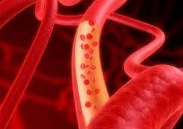 texnita-aggeia-apo-vlastika-kittara