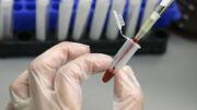 blood-test-karkinos-wothikwn