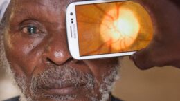 ofthalmologiki-kliniki-tsepis