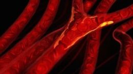 periferiki-artiriopatheia