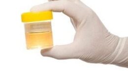 Urine Sample