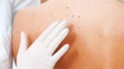 derma1