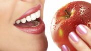 apples